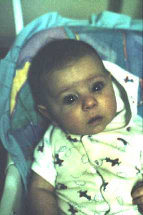 Jonathan on May 26, 2000 at 2 m and 9 d age